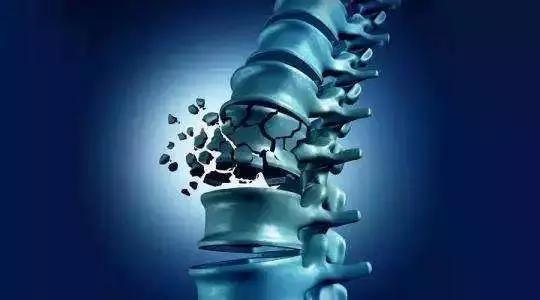 春夏補(bǔ)鈣好時(shí)期 骨密度儀來助陣