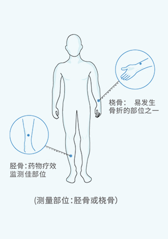 骨密度